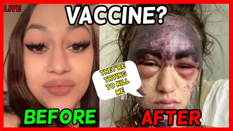 Alexis Vaccine Reaction in California