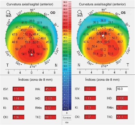 Anterior Curve In Healthcare
