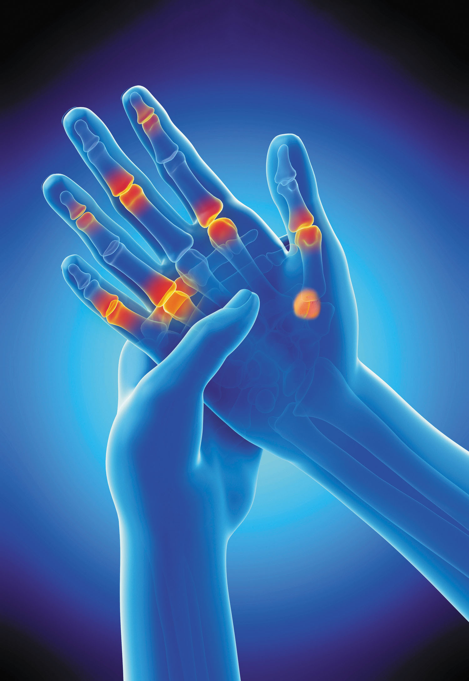 Arthritis Health Supplements