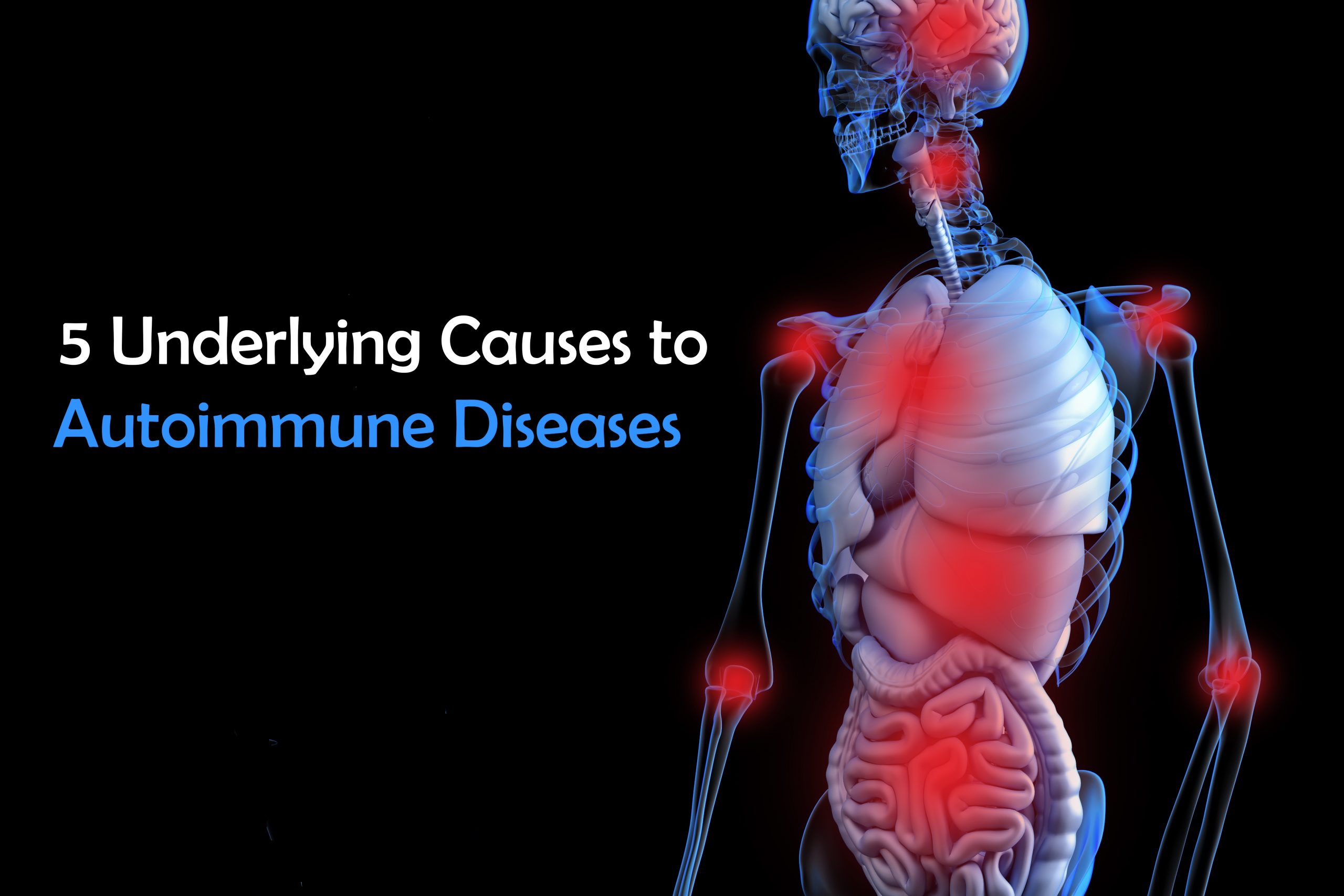 Autoimmune Diseases Symptoms Causes Types Diagnosis And Treatment Autoimmune Diseases Symptoms Causes Types Diagnosis And Treatment