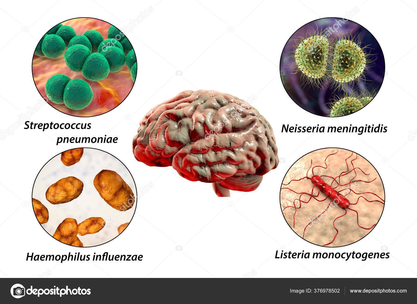 Be Meningitis Aware Have You Had Your Menacwy Vaccine Articles Be Meningitis Aware Have You Had Your Menacwy Vaccine Articles
