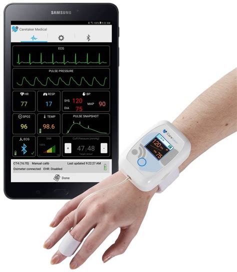Caretaker Medical Adds Continuous Beat By Beat Blood Pressure Caretaker Medical Adds Continuous Beat By Beat Blood Pressure