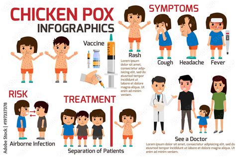 Children Has Chicken Pox Infographic Poster Children Fever And Children Has Chicken Pox Infographic Poster Children Fever And