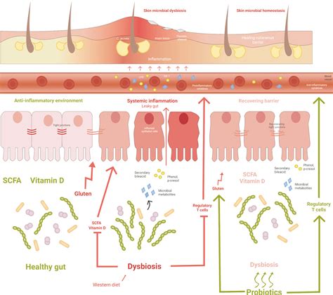Dermatologist Inflammation Skin Gut Health