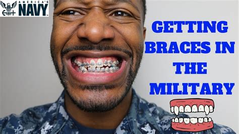 Does Military Pay For Braces
