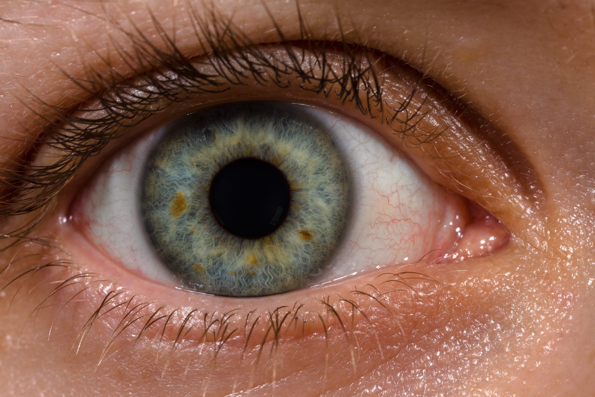 Eye Health Issues During Summer And How To Prevent Them