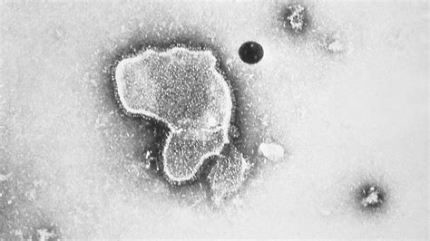 Fda Approves First Rsv Vaccine A Moment Six Decades In The Making Cnn Fda Approves First Rsv Vaccine A Moment Six Decades In The Making Cnn