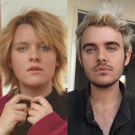 Ftm 5 Years On T Just Got My Top Surgery Date One Month From Today