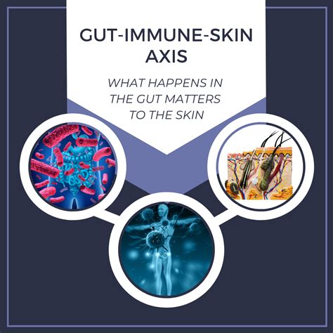 Gut Immune Skin Axis What Happens In The Gut Matters To The Skin Gut Immune Skin Axis What Happens In The Gut Matters To The Skin