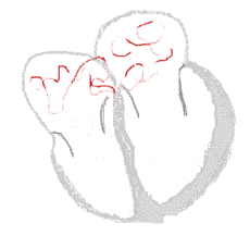 Heart Ct Scans In Chicagoland Ascension Heart Ct Scans In Chicagoland Ascension