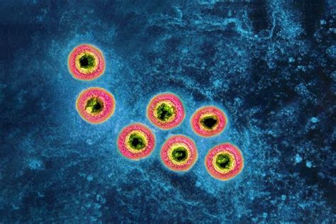 Herpes Vaccine Tests Underway By Company That Made Covid 19 Vaccines Herpes Vaccine Tests Underway By Company That Made Covid 19 Vaccines