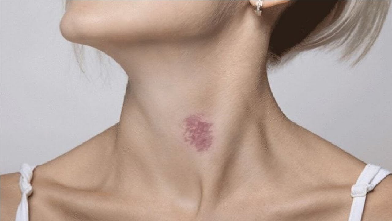 Hickey Christine Pa C Ampla Health Medical And Dental Services For Hickey Christine Pa C Ampla Health Medical And Dental Services For