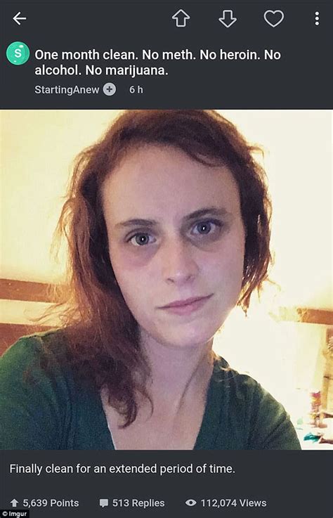 Imgur Image Falsely Suggests Woman Is A Drug Addict Daily Mail Online Imgur Image Falsely Suggests Woman Is A Drug Addict Daily Mail Online