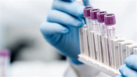 Lab Specimen Transport Solutions For Hospitals Swisslog Healthcare