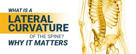 Lateral Curve In Healthcare