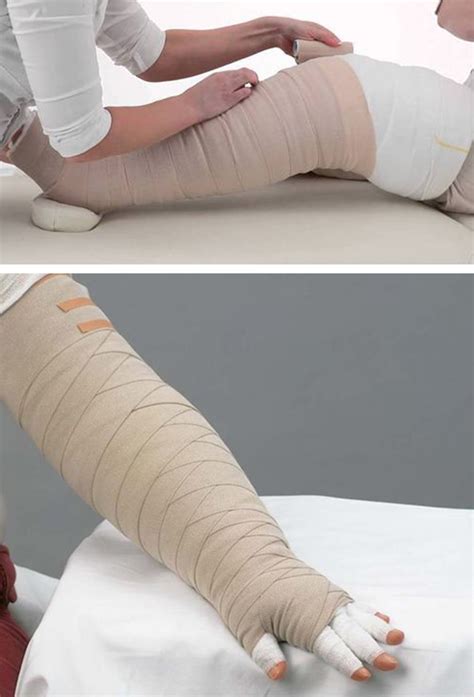 Lymphedema Connection To Agent Orange