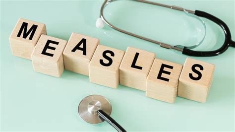 Macomb County Health Department Reports Local Measles Case Macomb County Macomb County Health Department Reports Local Measles Case Macomb County
