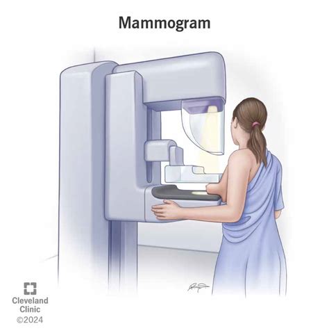 Mammography Mammography