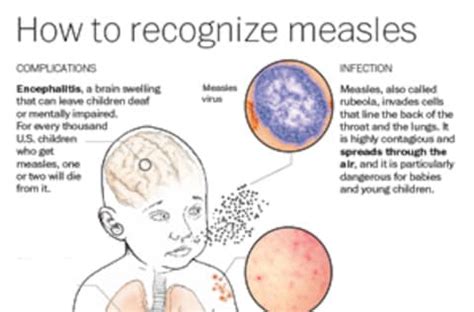 Measles Cases Are Spreading Despite High Vaccination Rates What S Measles Cases Are Spreading Despite High Vaccination Rates What S