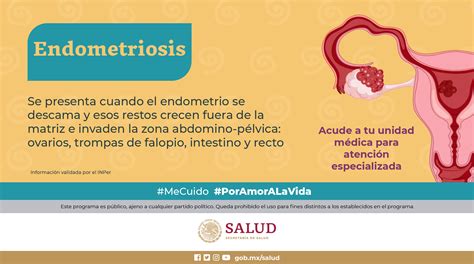 Mexico Health Surgery Resort Endometriosis