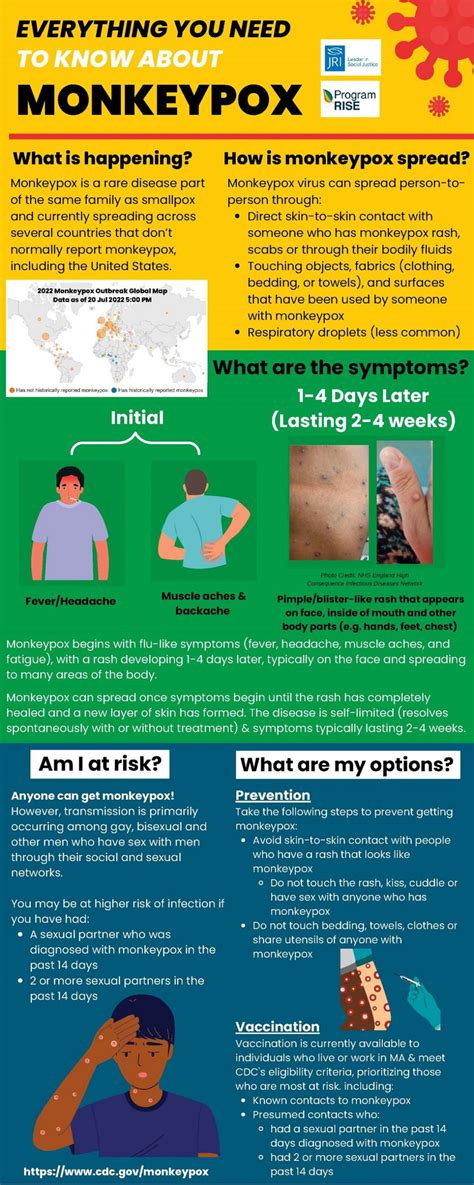 Monkeypox Information Board Of Health Nurse Monkeypox Information Board Of Health Nurse