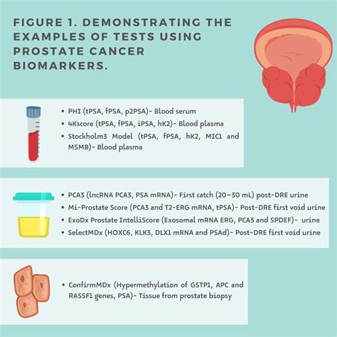 New Biomarkers In Prostate Cancer New Biomarkers In Prostate Cancer