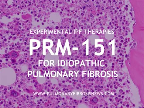 Pin On Idiopathic Fibrosis I P F Pin On Idiopathic Fibrosis I P F