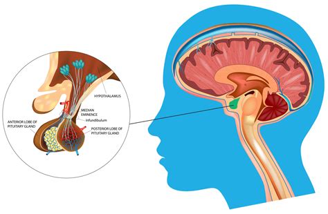 Pituitary Gland Health Problems