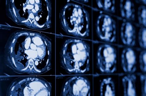 Premier Radiology Tennessee Computed Tomography