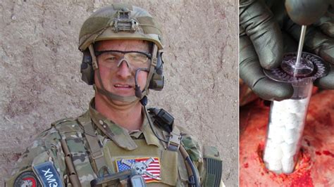 Stopping The Blood Ex Army Medic Still Helping Treat Battle Wounds Stopping The Blood Ex Army Medic Still Helping Treat Battle Wounds