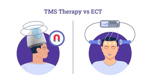 Tms Vs Electroconvulsive Therapy Ect Understanding The Differences Tms Vs Electroconvulsive Therapy Ect Understanding The Differences