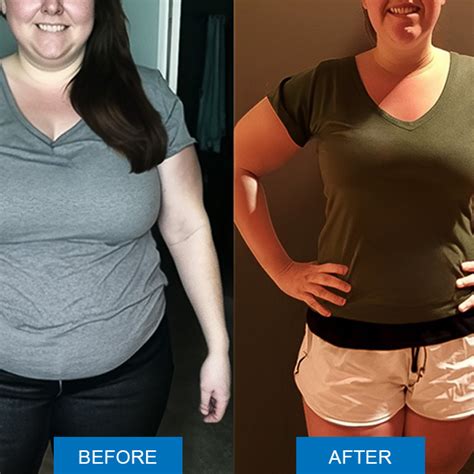 Weight Loss Zappy Health Weight Loss Zappy Health