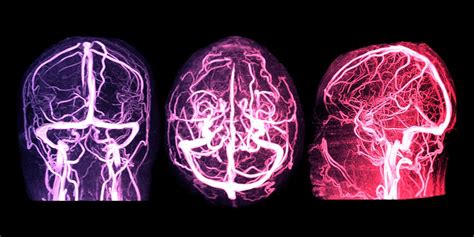 What You Need To Know About Mri With Contrast American Health Imaging What You Need To Know About Mri With Contrast American Health Imaging