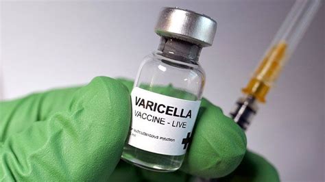 When Was The Chickenpox Vaccine Created